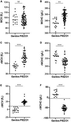 Rapid Gardos Hereditary Xerocytosis Diagnosis in 8 Families Using Reticulocyte Indices